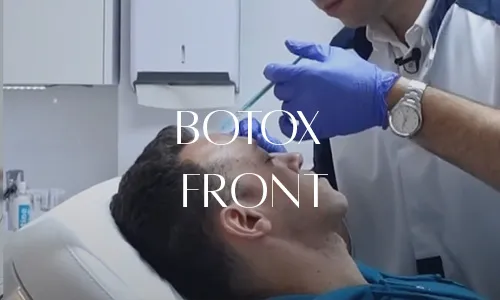RIDES DU FRONT
