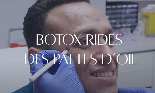 PATTES D'OIE