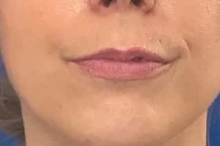 Rééquilibrage asymétrique
