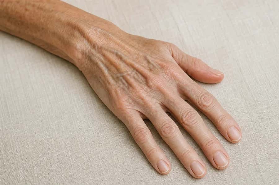 Fonte des volumes : mains « squelettisées »
