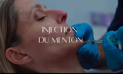 Menton en retrait