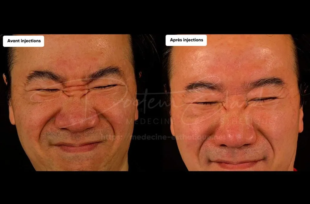 Treatment result