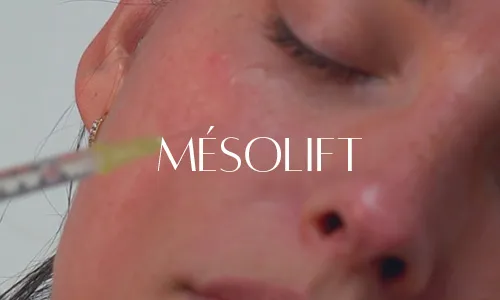 Mésolift