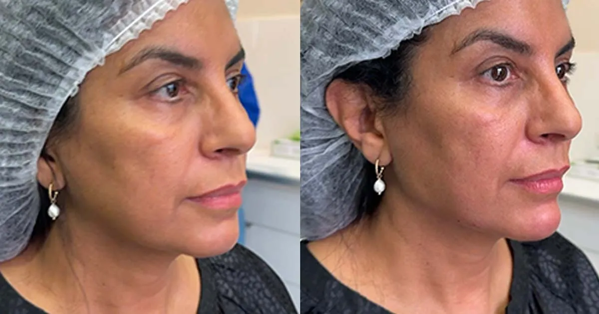 Treatment result