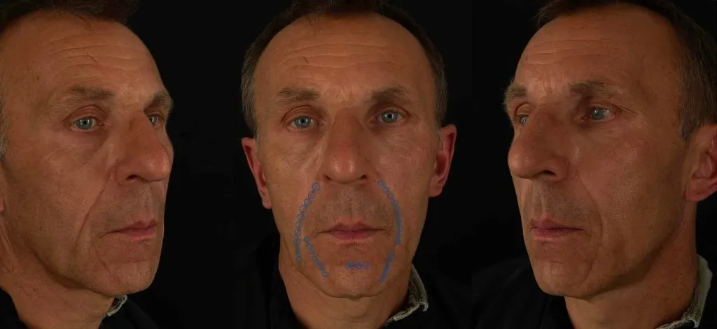 Treatment result